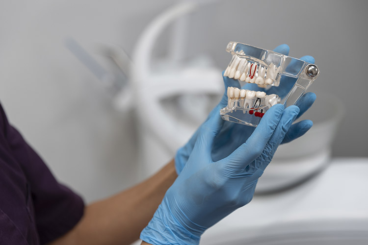 dental implant in turkey