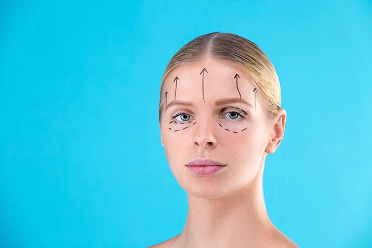 Forehead Lift